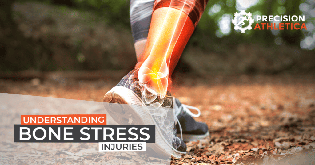 Bone Stress Injuries